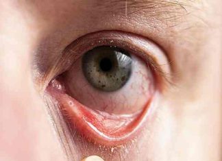 Nhìn tướng mắt có tia máu đỏ dấu hiệu xấu hay phúc tướng? Nhìn tướng mắt có tia máu đỏ dấu hiệu xấu hay phúc tướng?