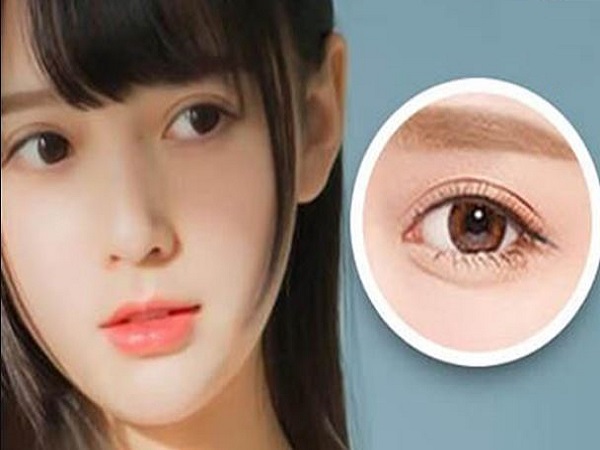 Mắt giọt lệ là gì?