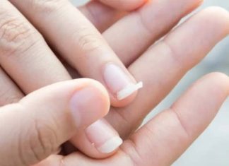 Luận giải gãy móng tay trái, phải có điềm gì, tốt hay xấu?