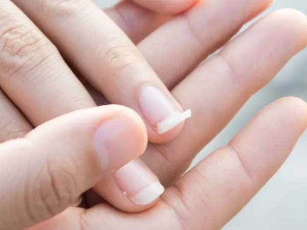 Gãy móng tay là điềm gì theo tâm linh?