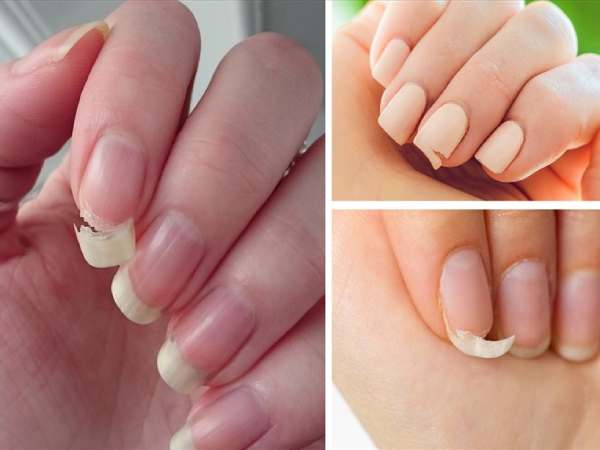 Gãy móng tay trái điềm gì?